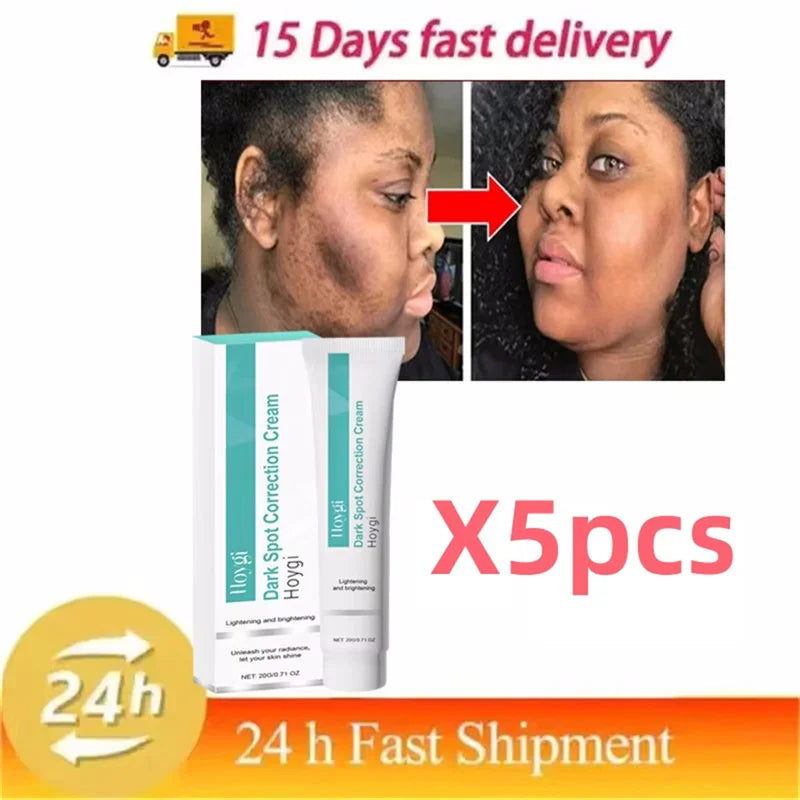 Clinical Pigment Corrector Cream – Melasma & Dark Spot Repair