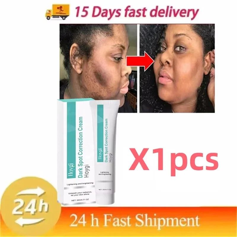 Clinical Pigment Corrector Cream – Melasma & Dark Spot Repair