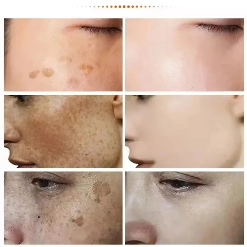 Clinical Pigment Corrector Cream – Melasma & Dark Spot Repair