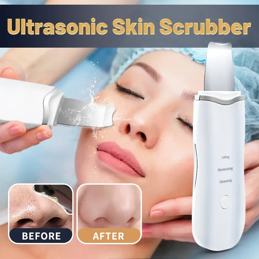 GlowPro™ Ultrasonic Skin Scrubber – Instantly Remove Blackheads & Reveal Clear, Glowing Skin ✨