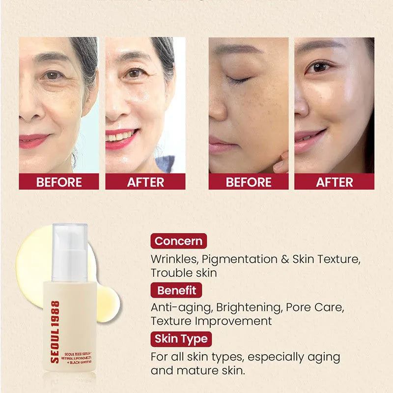 SEOUL 1988 Retinol Pore-Minimizing Serum
