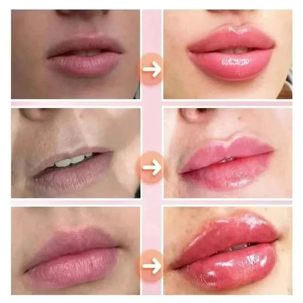 SoftPlump Lip Glow Serum 💋