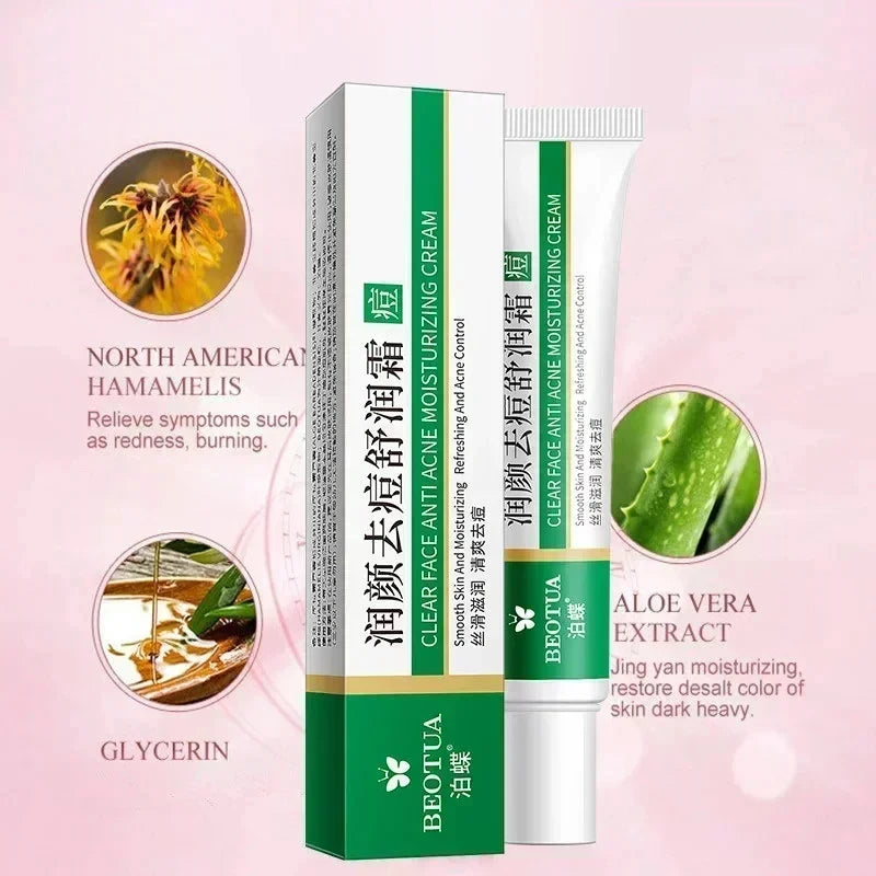 Korean Acne Care Gel – Clear Pores & Healthy Glow