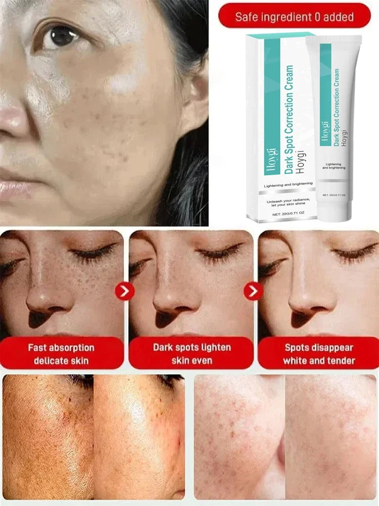 Clinical Pigment Corrector Cream – Melasma & Dark Spot Repair