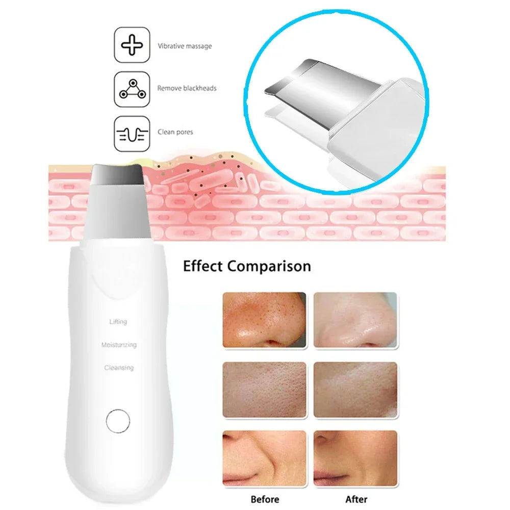GlowPro™ Ultrasonic Skin Scrubber – Instantly Remove Blackheads & Reveal Clear, Glowing Skin ✨