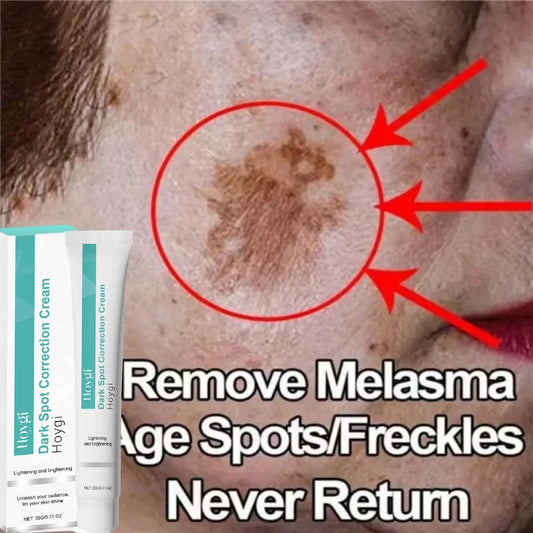 Clinical Pigment Corrector Cream – Melasma & Dark Spot Repair